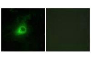 Immunofluorescence analysis of HeLa cells, using GRK6 antibody. (GRK6 Antikörper  (N-Term))