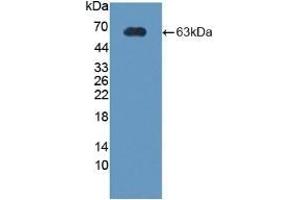 Detection of Recombinant CRHBP, Rat using Polyclonal Antibody to Corticotropin Releasing Hormone Binding Protein (CRHBP) (CRHBP Antikörper  (AA 25-322))