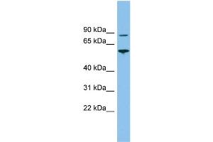 WB Suggested Anti-VPS52 Antibody Titration: 0.