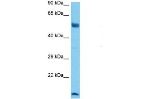 Host:  Mouse  Target Name:  RUNX1  Sample Tissue:  Mouse Brain  Antibody Dilution:  1ug/ml (RUNX1 Antikörper  (N-Term))