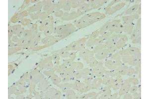 Immunohistochemistry of paraffin-embedded human heart tissue using ABIN7142399 at dilution of 1:100