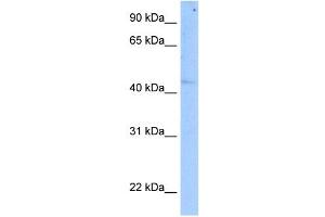 SETD7 antibody used at 5 ug/ml to detect target protein. (SETD7 Antikörper)
