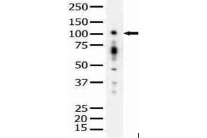 Image no. 1 for anti-Protein Kinase D1 (PRKD1) antibody (ABIN272066) (PKC mu Antikörper)