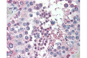 MED4 antibody was used for immunohistochemistry at a concentration of 4-8 ug/ml. (MED4 Antikörper  (C-Term))