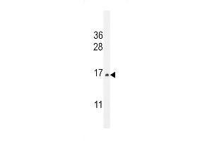 Western blot analysis in HepG2 cell line lysates (35ug/lane). (CST9 Antikörper  (C-Term))