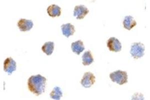 Image no. 2 for anti-Nerve Growth Factor Receptor (NGFR) antibody (ABIN318704) (NGFR Antikörper)
