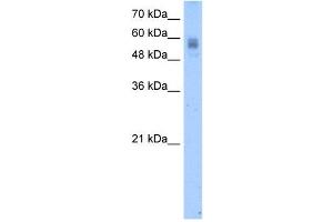 Protein C antibody used at 2. (PROC Antikörper)