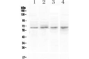 Western blot analysis of CCKBR using anti-CCKBR antibody . (CCKBR Antikörper)