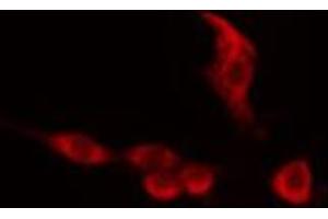 ABIN6274154 staining 293 cells by IF/ICC. (HNRNPC Antikörper  (C-Term))