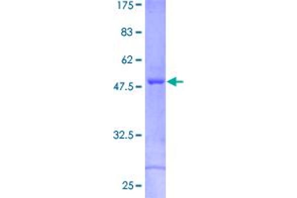 CRYbA2 Protein (AA 1-197) (GST tag)