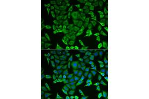 Immunofluorescence analysis of MCF-7 cells using RARS antibody (ABIN5973728). (RARS Antikörper)