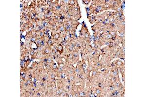 IHC analysis of Chat using anti-Chat antibody (ABIN7600421).