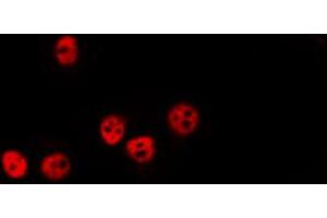 ABIN6274039 staining HepG2 by IF/ICC. (PPP1CA + 1CB Antikörper)