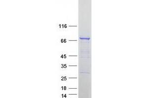 Western Blotting (WB) image for Dynein, Cytoplasmic 1, Intermediate Chain 1 (DYNC1I1) (Transcript Variant 1) protein (Myc-DYKDDDDK Tag) (ABIN2719864)