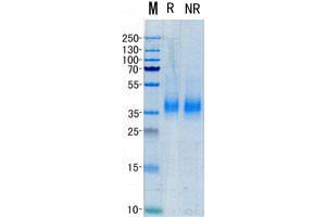 Western Blotting (WB) image for Tumor Necrosis Factor (Ligand) Superfamily, Member 11 (TNFSF11) (Transcript Variant 1) (Active) protein (His tag) (ABIN2713552)