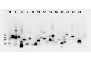 Western Blotting (WB) image for anti-DYKDDDDK Tag antibody (ABIN400789) (DYKDDDDK Tag Antikörper)