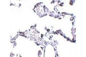 Immunohistochemistry of CD81 in human lung tissue with CD81 antibody at 5 μg/ml. (CD81 Antikörper  (N-Term))