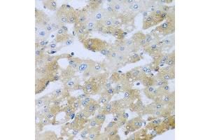 Immunohistochemistry of paraffin-embedded human liver injury using AP1M2 antibody at dilution of 1:100 (x40 lens). (AP1m2 Antikörper)