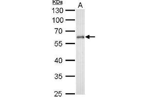 CYP1B1 Antikörper  (Center)