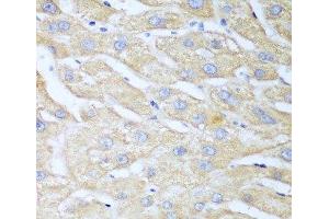 Immunohistochemistry of paraffin-embedded Human liver using NUDT15 Polyclonal Antibody at dilution of 1:100 (40x lens). (NUDT15 Antikörper)