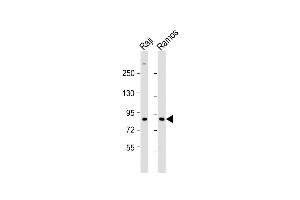 All lanes : Anti-IKBKE Antibody  at 1:1000 dilution Lane 1: Raji whole cell lysate Lane 2: Ramos whole cell lysate Lysates/proteins at 20 μg per lane.