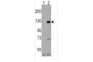 Western blot analysis of DAAM1 using rabbit polyclonal DAAM1 Antibody(Human C-term) using 293 cell lysates (2 ug/lane) either nontransfected (Lane 1) or transiently transfected with the DAAM1 gene (Lane 2). (DAAM1 Antikörper  (C-Term))
