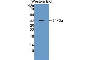 Detection of Recombinant ENDOG, Human using Polyclonal Antibody to Endonuclease G, Mitochondrial (ENDOG) (Endonuclease G Antikörper  (AA 16-290))