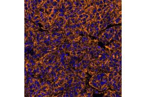 Immunofluorescence (IF) image for anti-Poliovirus Receptor (PVR) (AA 28-329) antibody (ABIN7449549) (Rekombinanter Poliovirus Receptor Antikörper  (AA 28-329))