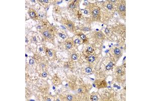 Immunohistochemistry of paraffin-embedded human liver injury using AMY2A antibody (ABIN5975245) at dilution of 1/100 (40x lens). (AMY2A Antikörper)