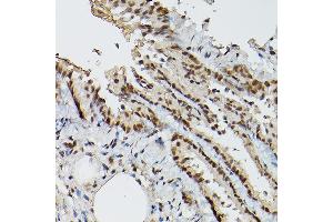 Immunohistochemistry of paraffin-embedded rat lung using ESE1/ELF3 Rabbit pAb (ABIN6130347, ABIN6140125, ABIN6140127 and ABIN6221990) at dilution of 1:150 (40x lens).