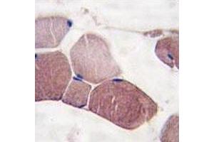 IHC analysis of FFPE human skeletal muscle tissue stained with UCHL3 antibody