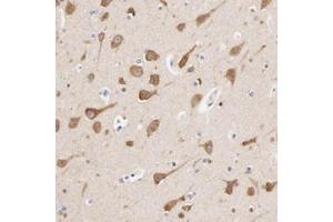 Immunohistochemistry (Formalin/PFA-fixed paraffin-embedded sections) of human lateral ventricle wall with HS3ST1 polyclonal antibody  shows strong cytoplasmic positivity in neuronal cells.
