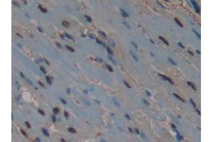 Immunohistochemistry (IHC) image for anti-Caspase 14, Apoptosis-Related Cysteine Peptidase (CASP14) (AA 17-248) antibody (ABIN1858238)