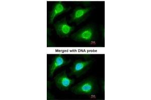 ICC/IF Image Immunofluorescence analysis of paraformaldehyde-fixed HeLa, using 20S Proteasome alpha1, antibody at 1:200 dilution. (Proteasome 20S alpha 1 (Center) Antikörper)