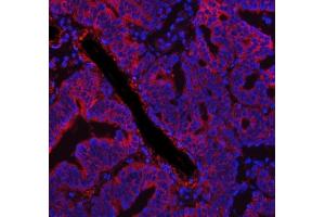IF analysis of FASN using anti-FASN antibody (ABIN3044520).