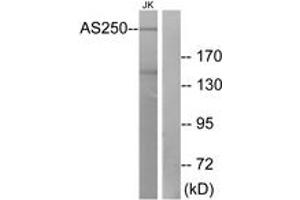 Western blot analysis of extracts from Jurkat cells, using AS250 Antibody. (RALGAPA2 Antikörper  (AA 641-690))