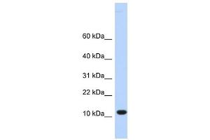 C10ORF57 antibody used at 1 ug/ml to detect target protein. (CJ057 Antikörper  (Middle Region))