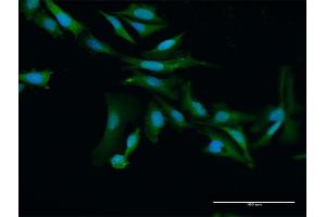 Immunofluorescence of purified MaxPab antibody to PRAME on HeLa cell. (PRAME Antikörper  (AA 1-509))
