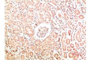 Immunohistochemical analysis of paraffin-embedded Human Kidney Tissue using Collagen IV Mouse mAb diluted at 1:200. (COL4A1 Antikörper)