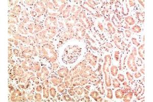 Immunohistochemistry (IHC) image for anti-Collagen, Type IV, alpha 1 (COL4A1) antibody (ABIN7189176)