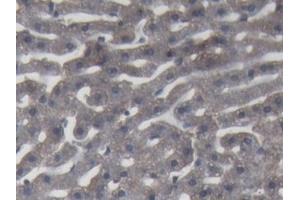 DAB staining on IHC-P; Samples: Rabbit Liver Tissue (C9 Antikörper  (AA 139-519))