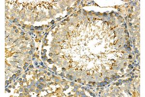 ABIN6264529 and ABIN6278030 at 1/100 staining Rat testis tissue by IHC-P.