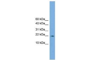 PPIL3 antibody used at 1 ug/ml to detect target protein. (PPIL3 Antikörper)