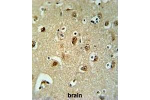Immunohistochemistry (IHC) image for anti-UDP-Gal:betaGal beta 1,3-Galactosyltransferase Polypeptide 6 (B3GALT6) antibody (ABIN3002204) (B3GALT6 Antikörper)