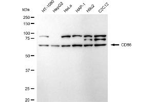 Western blotting analysis using CD86 antibody (ABIN7797986).