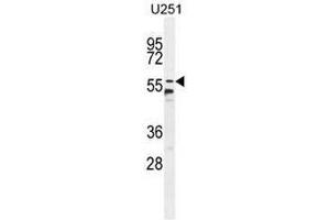 CCDC9 Antibody (N-term) western blot analysis in U251 cell line lysates (35µg/lane). (CCDC9 Antikörper  (N-Term))