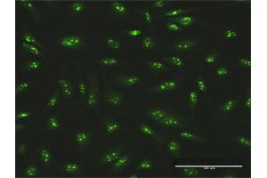 Immunofluorescence of purified MaxPab antibody to SMARCA5 on HeLa cell.