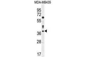 CASP3 Antibody (C-term) western blot analysis in MDA-MB435 cell line lysates (35µg/lane). (Caspase 3 Antikörper  (C-Term))