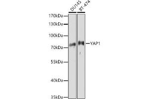 Western blot analysis of extracts of various cell lines, using Y antibody (ABIN6132787, ABIN6150315, ABIN6150320 and ABIN6214108) at 1:1000 dilution. (YAP1 Antikörper  (AA 155-504))