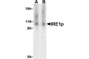 Western blot analysis of IRE1p in Raji cell lysate with AP30446PU-N IRE1p antibody at (A) 1 and (B) 2 μg/ml. (ERN1 Antikörper  (Intermediate Domain))